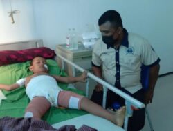 Bocah di Konsel Alami Luka Bakar, Personel Polsek Mowila Bantu Ringankan Biaya Perawatan