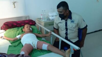 Bocah di Konsel Alami Luka Bakar, Personel Polsek Mowila Bantu Ringankan Biaya Perawatan