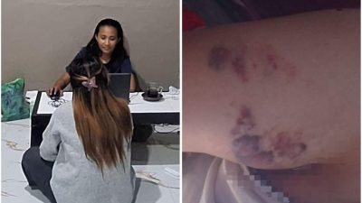 Dilaporkan Berkali-kali, Dugaan Penganiayaan di Kendari Belum Tuntas, Korban Mengadu ke KPKM Sultra
